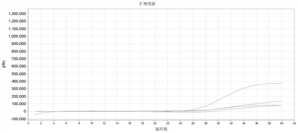 Primer probe combination and kit for early diagnosis, metastasis early warning and prognosis evaluation of prostate cancer and application of primer probe combination and kit