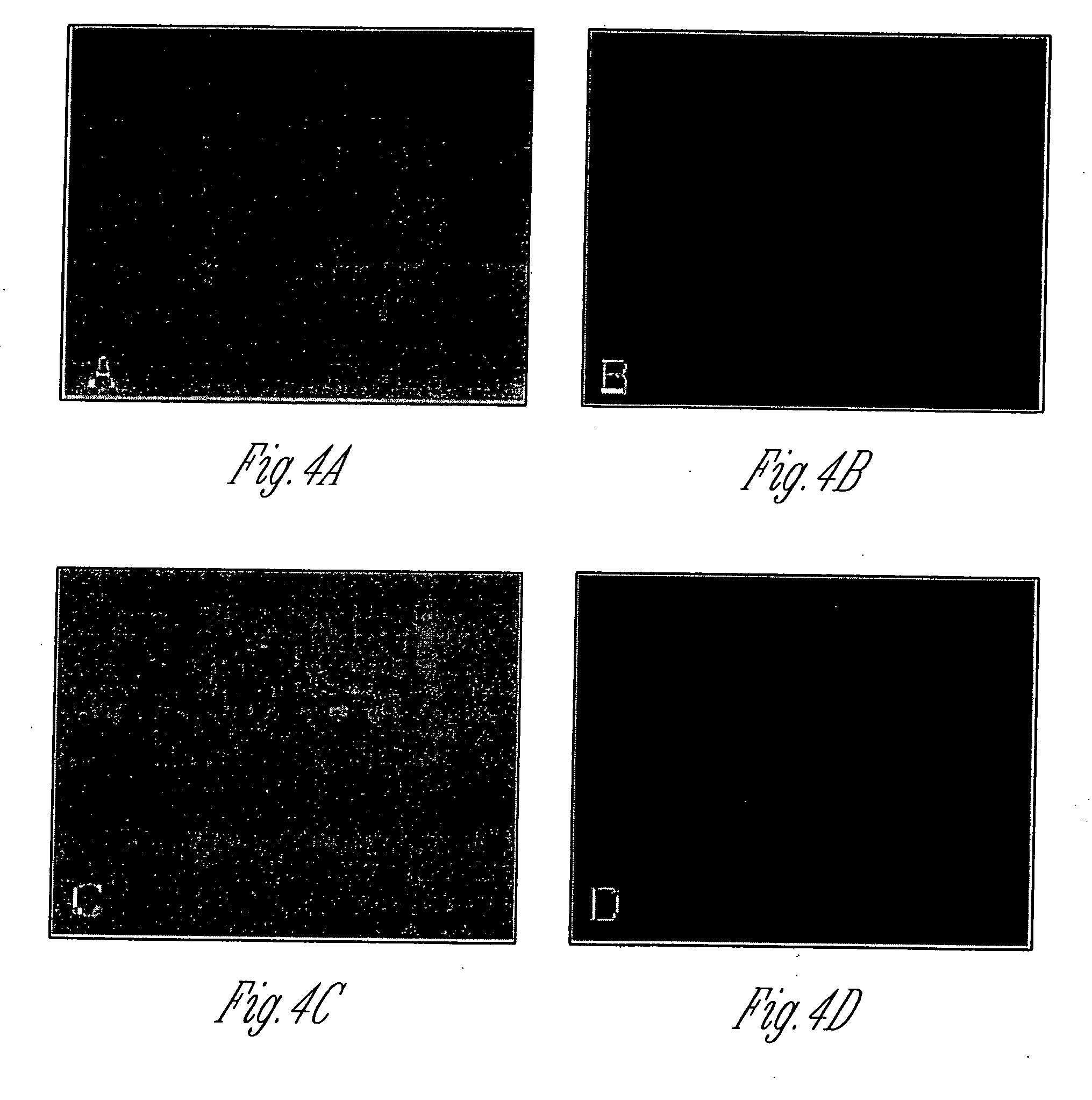 Kidney derived stem cells and methods for their isolation, differentiation and use