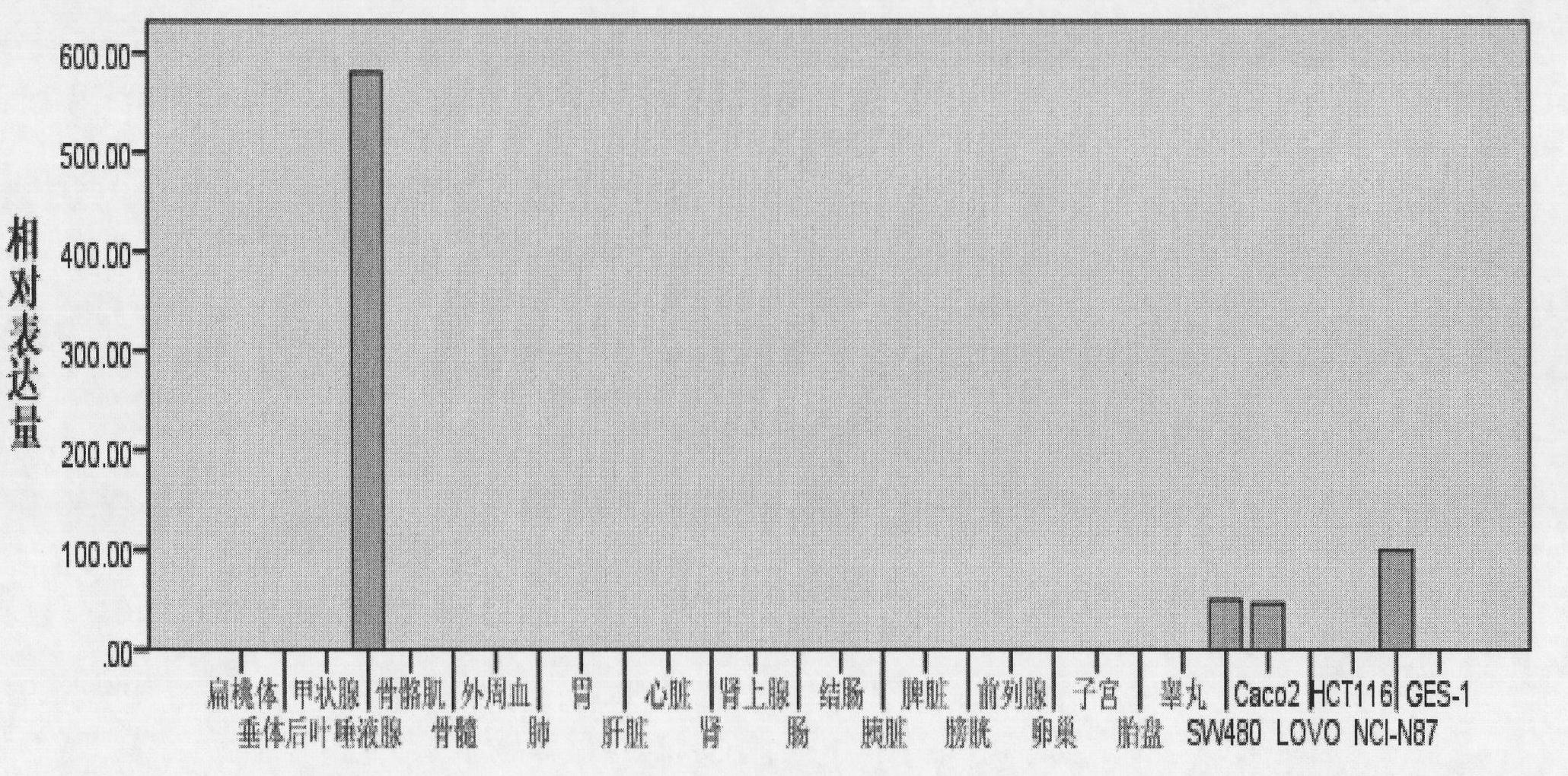 New molecular marker for diagnosis and prediction of gastrointestinal tumor