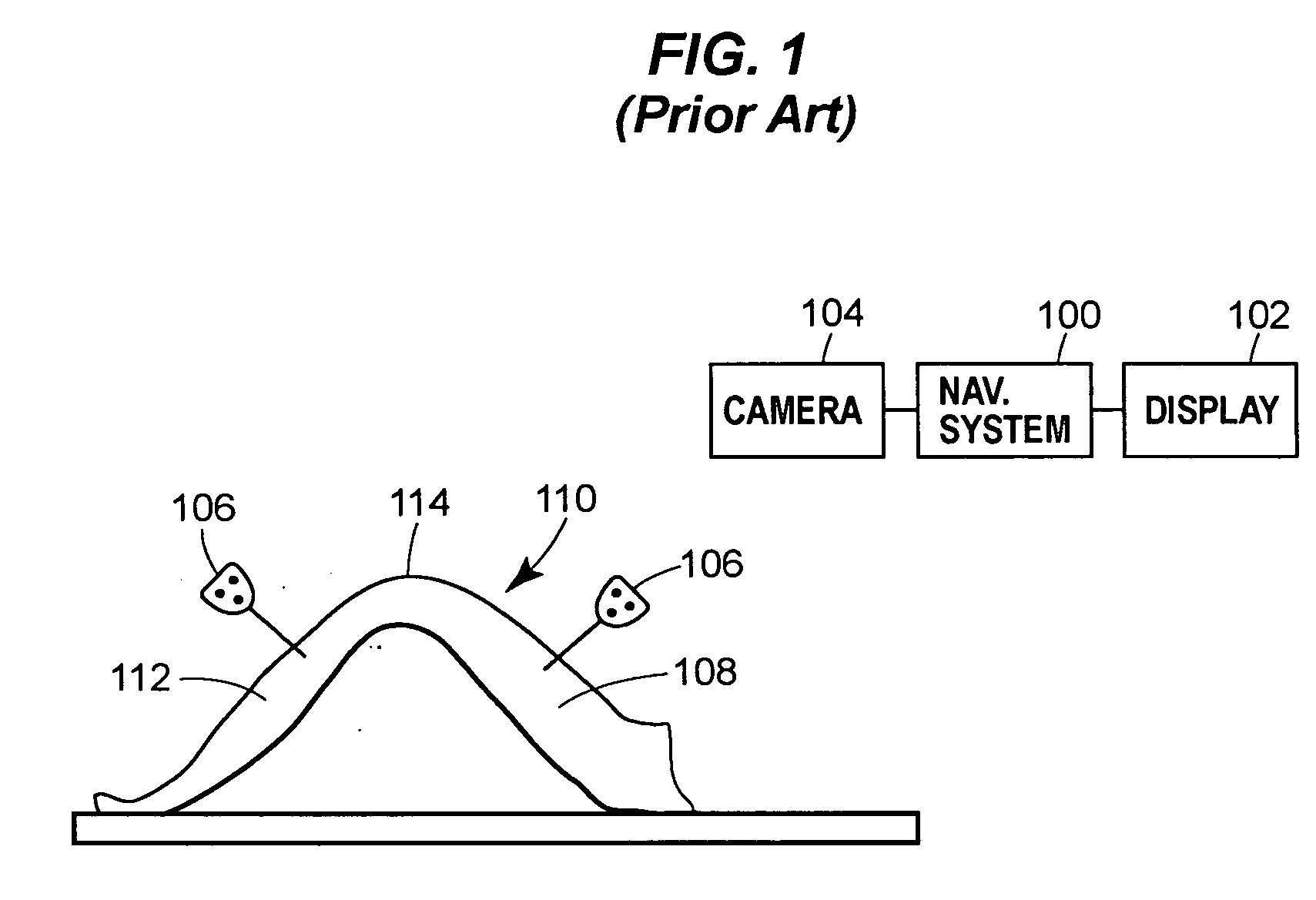 System and method for bone resection