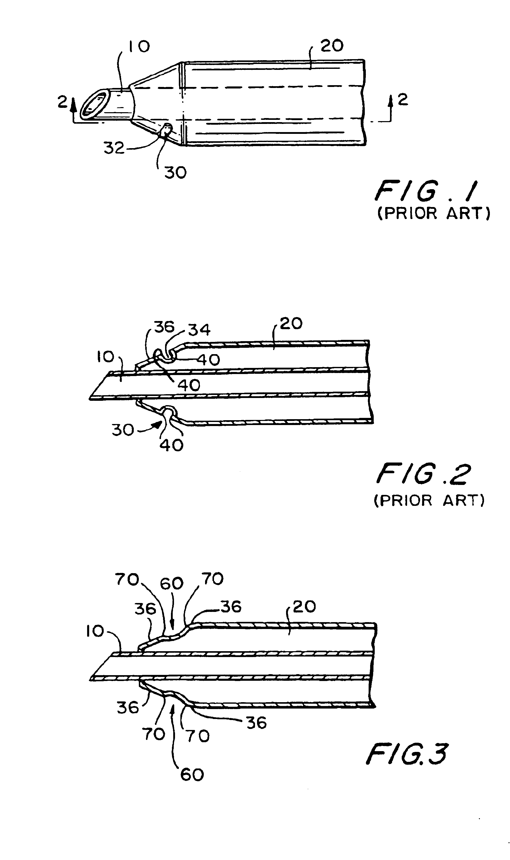 Tapered infusion sleeve portal