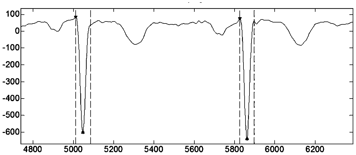 qrs complex detection method