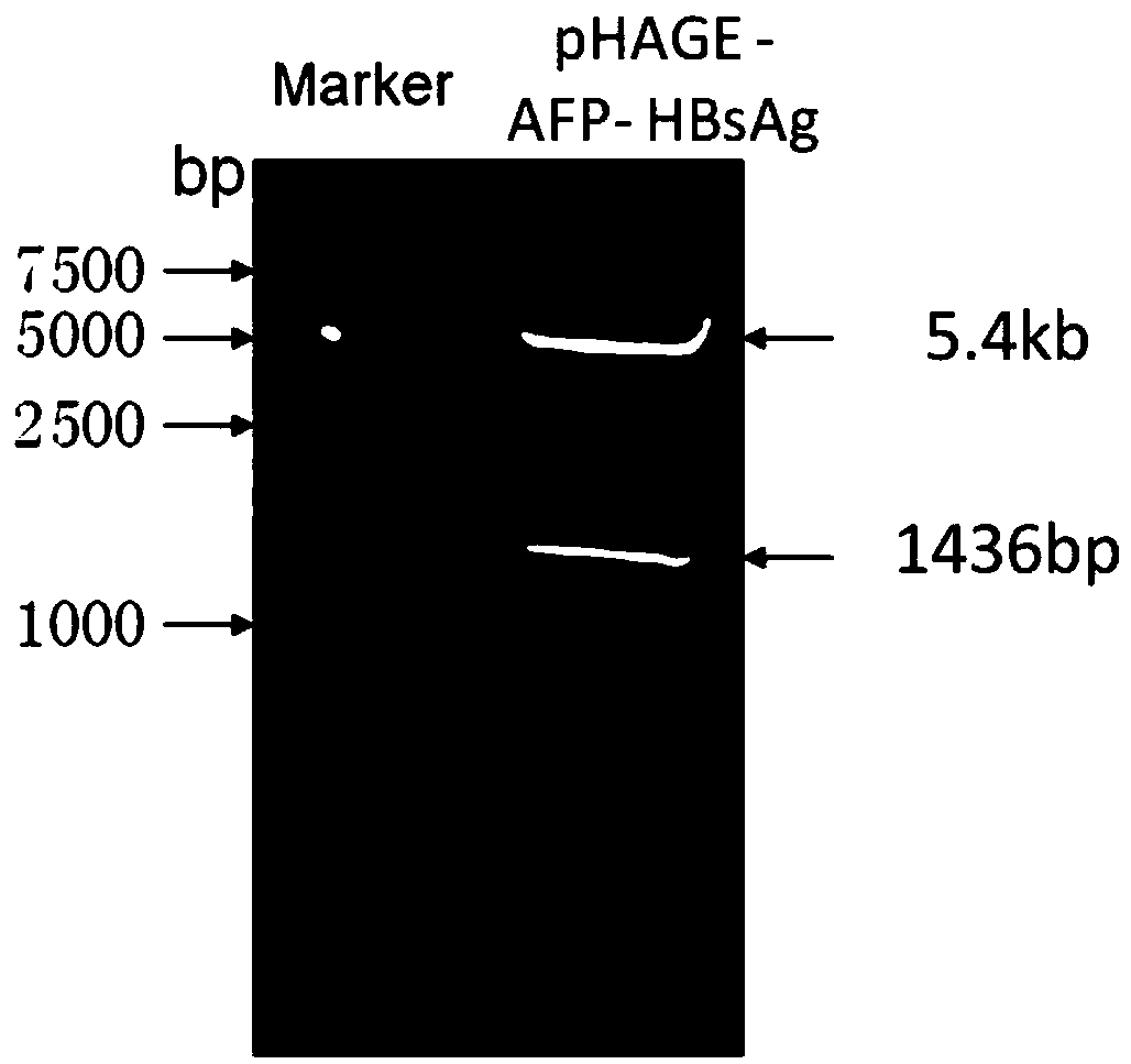 DC (Dendritic cell)-CIK (Cytokine-induced killer cell) immune cell modified by both AFP (Alpha-fetoprotein) and HBsAg (Hepatitis B surface antigen) antigen genes as well as preparation method and application of the cell