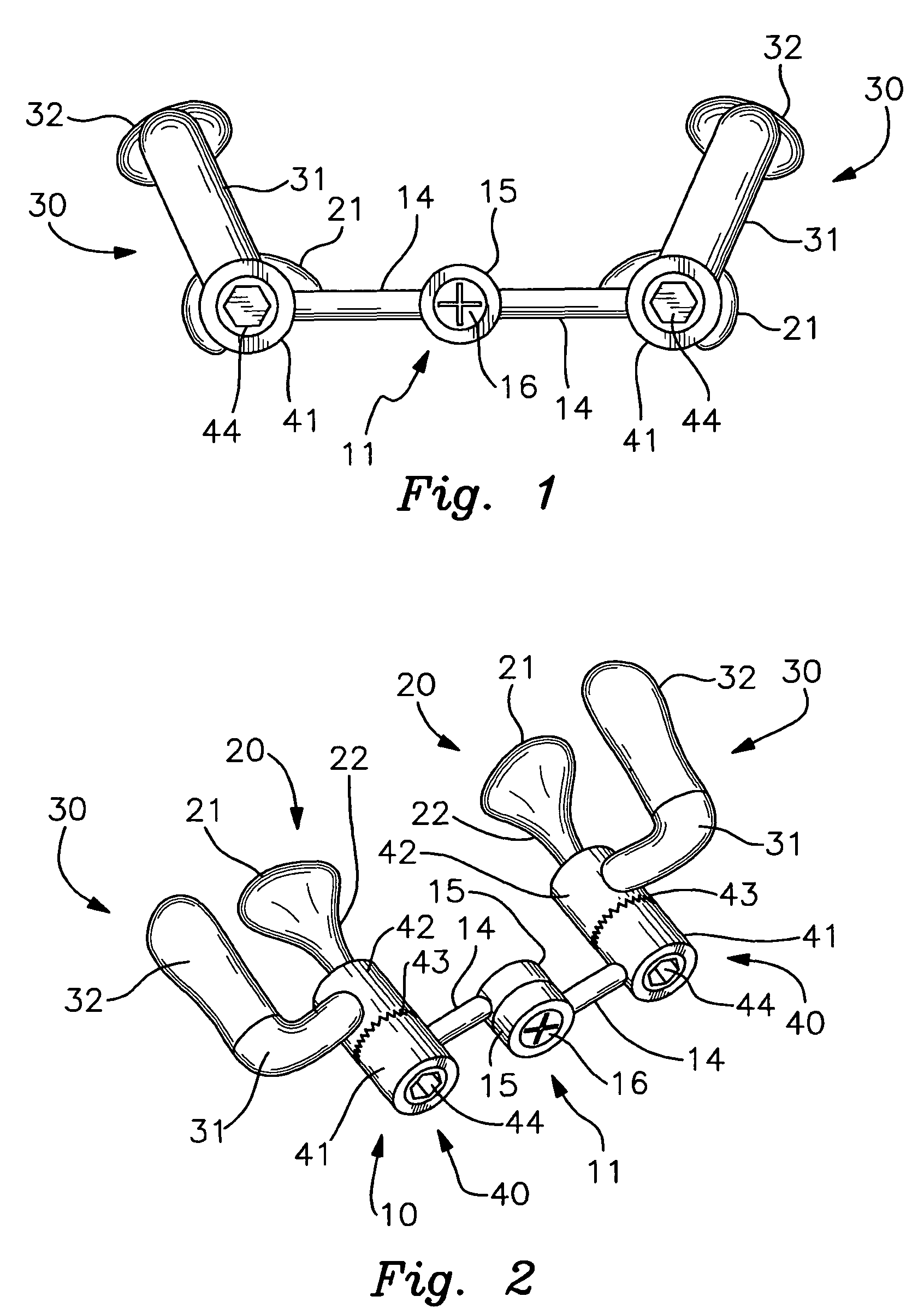 Dynamic nasal molding device