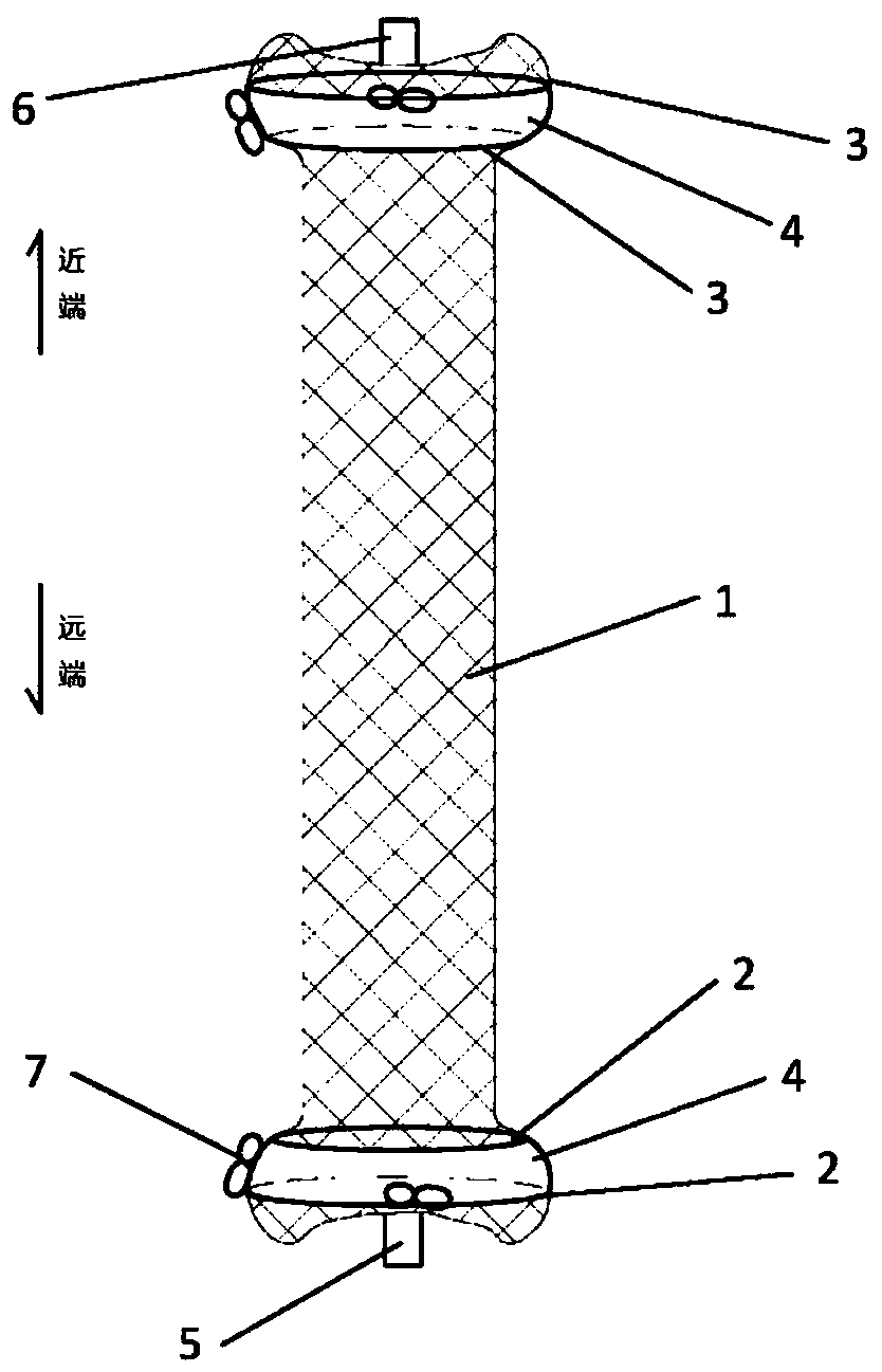 A kind of intravascular false lumen occlusion stent