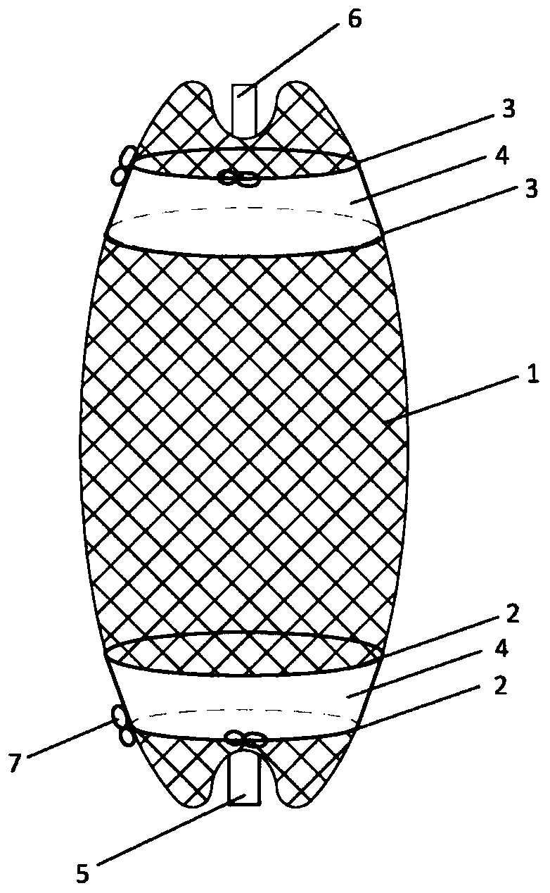 A kind of intravascular false lumen occlusion stent