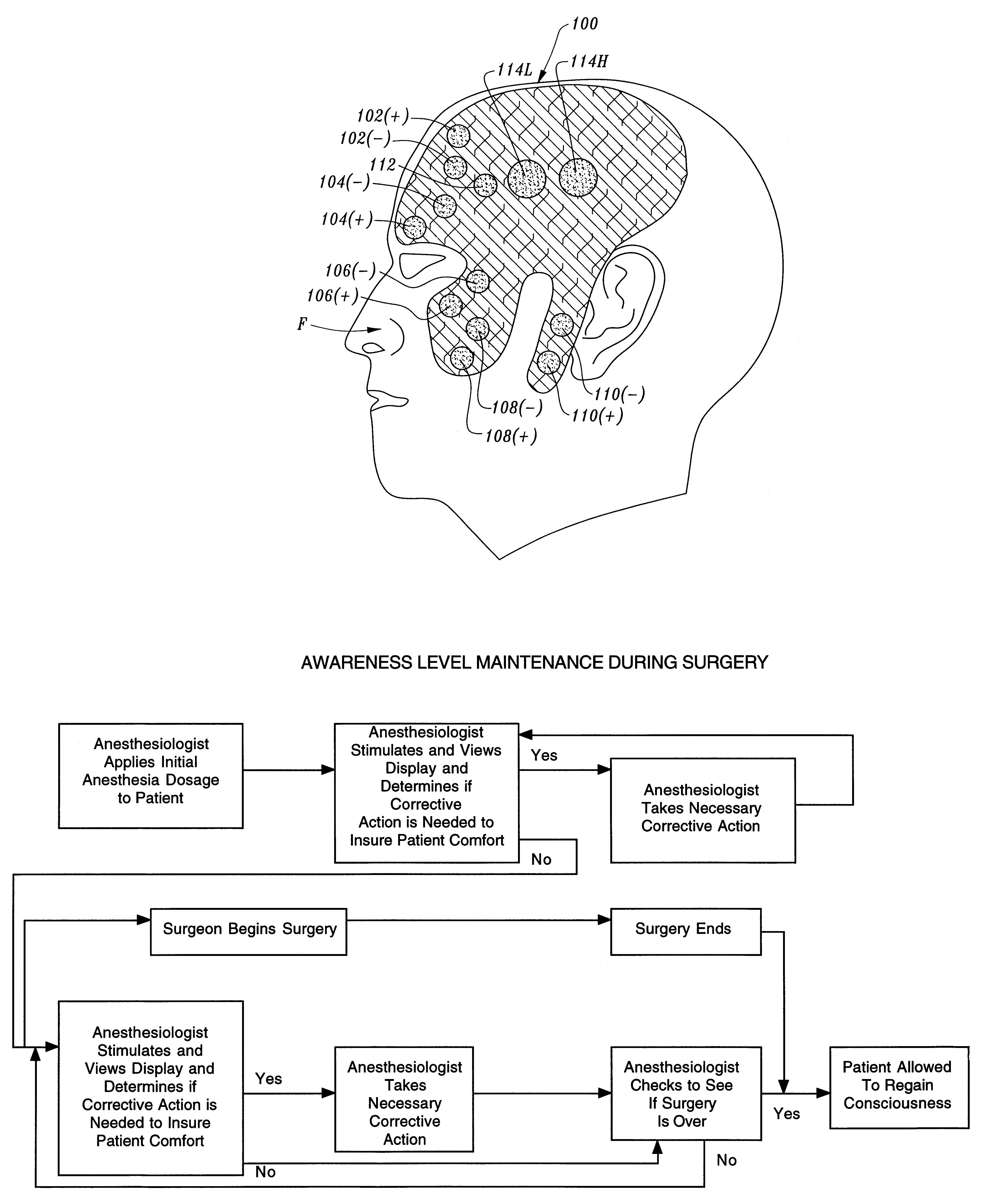 Electrode assembly and method for signaling a monitor