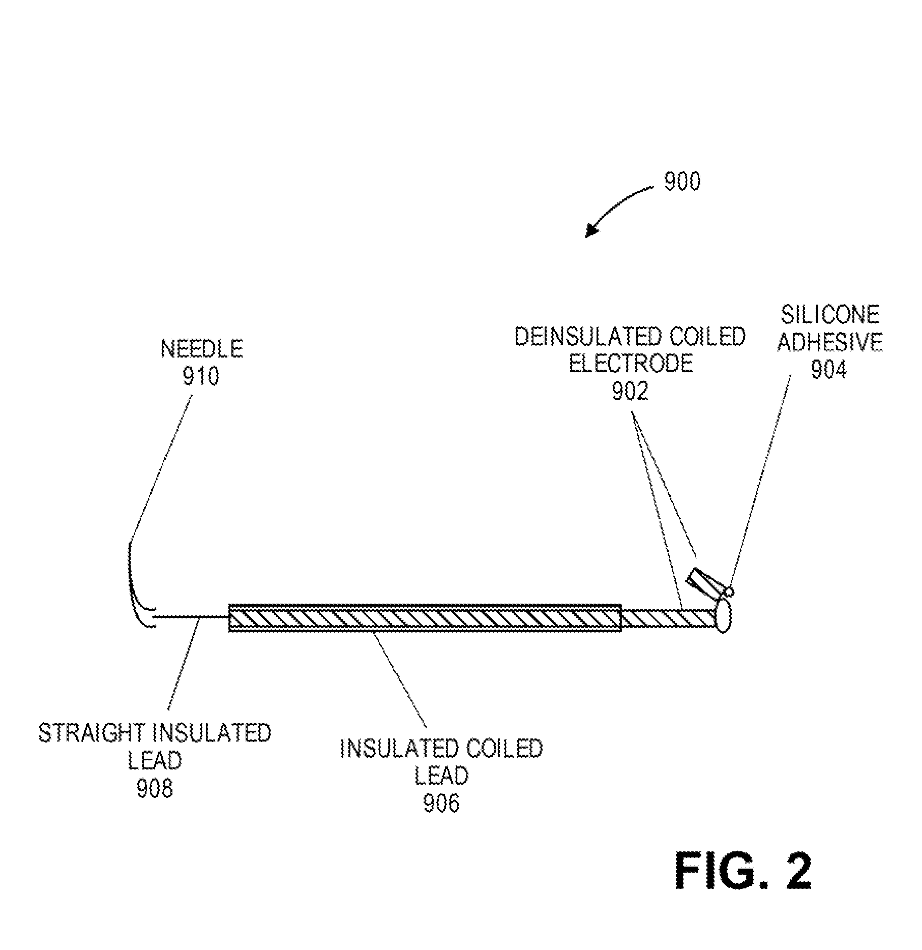 Ventilatory assist system and methods to improve respiratory function