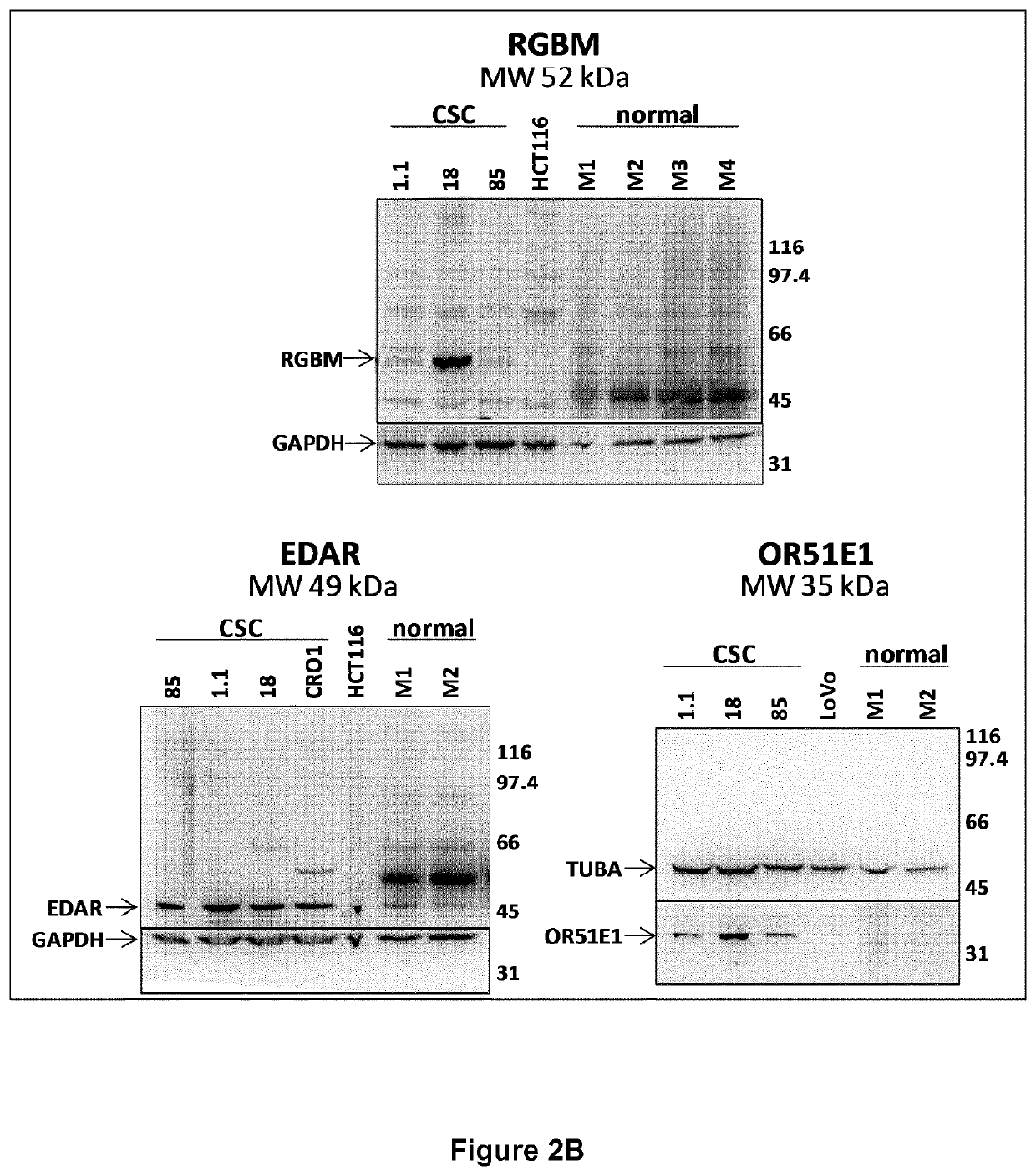 Monoclonal antibody Anti-fgfr4