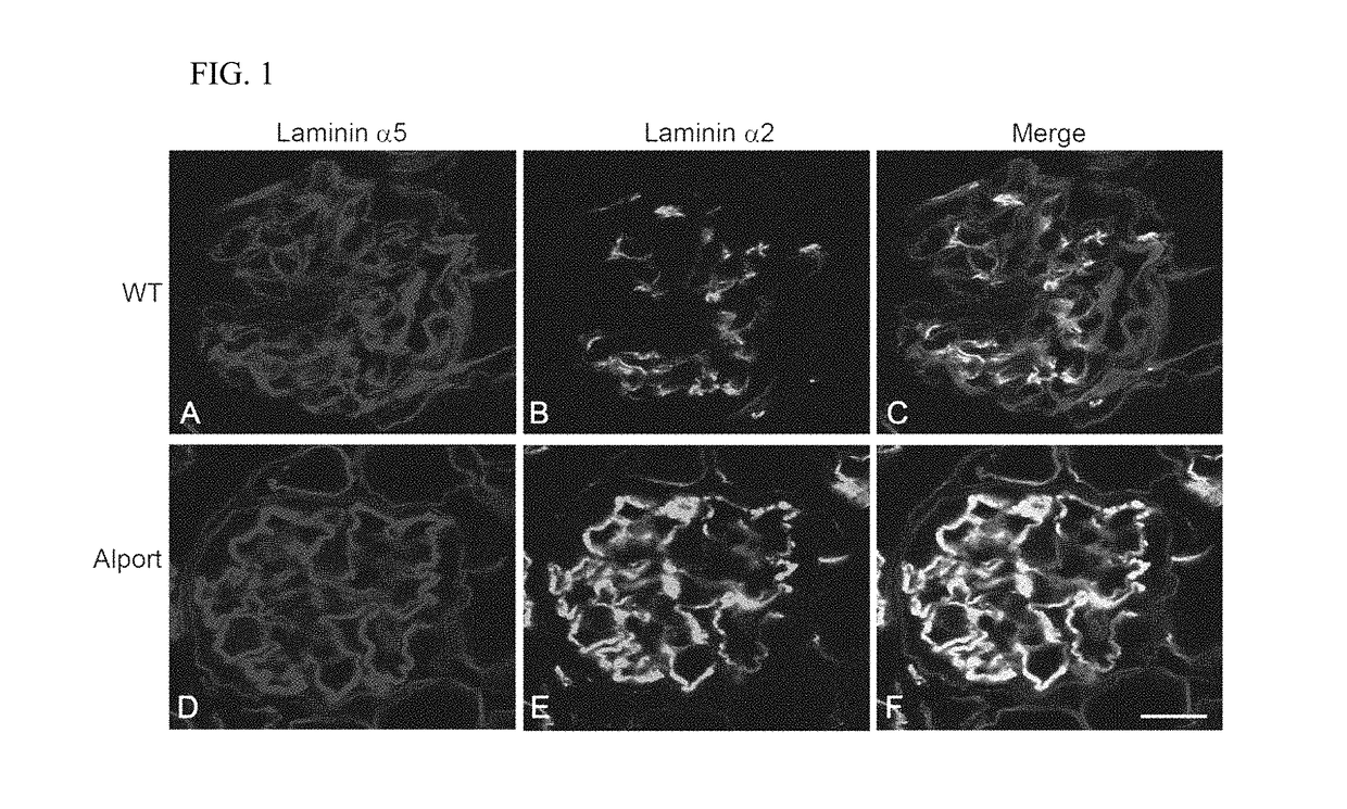 RAC1 inhibitors for the treatment of alport glomerular disease