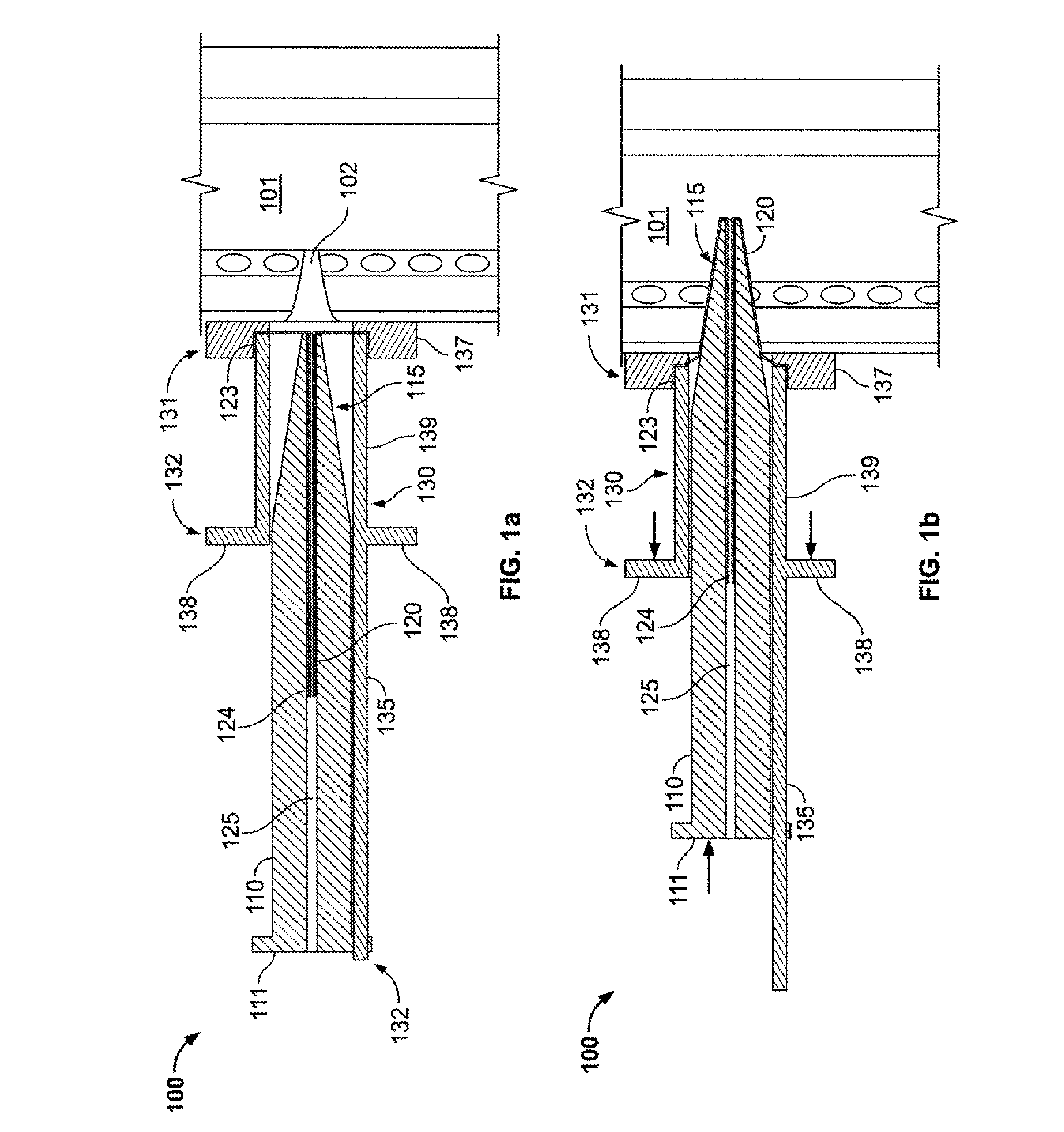 Everting device and method for tracheostomy