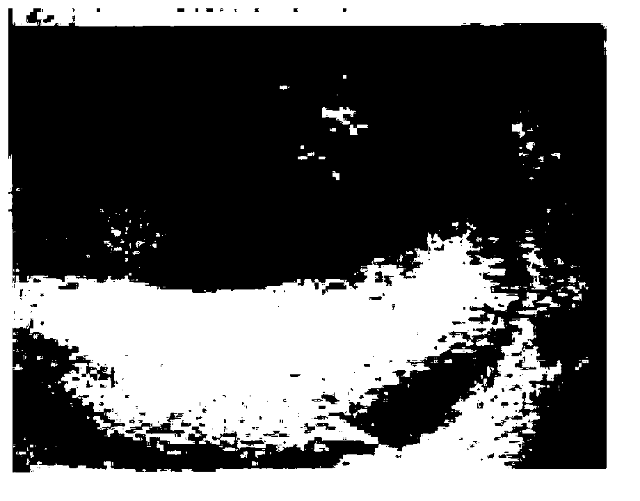 Traditional Chinese medicine composition for treating gastric diseases of human body as well as preparation method and application thereof