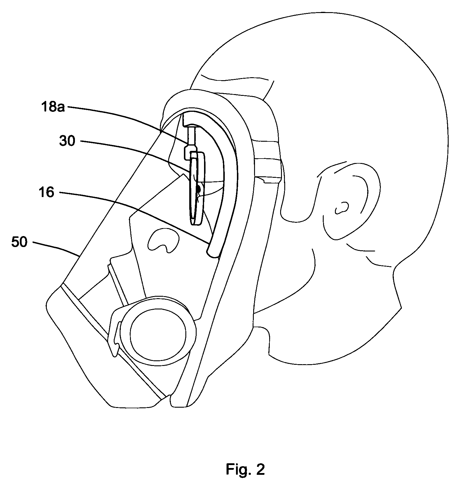 Adjustable spectacle kit