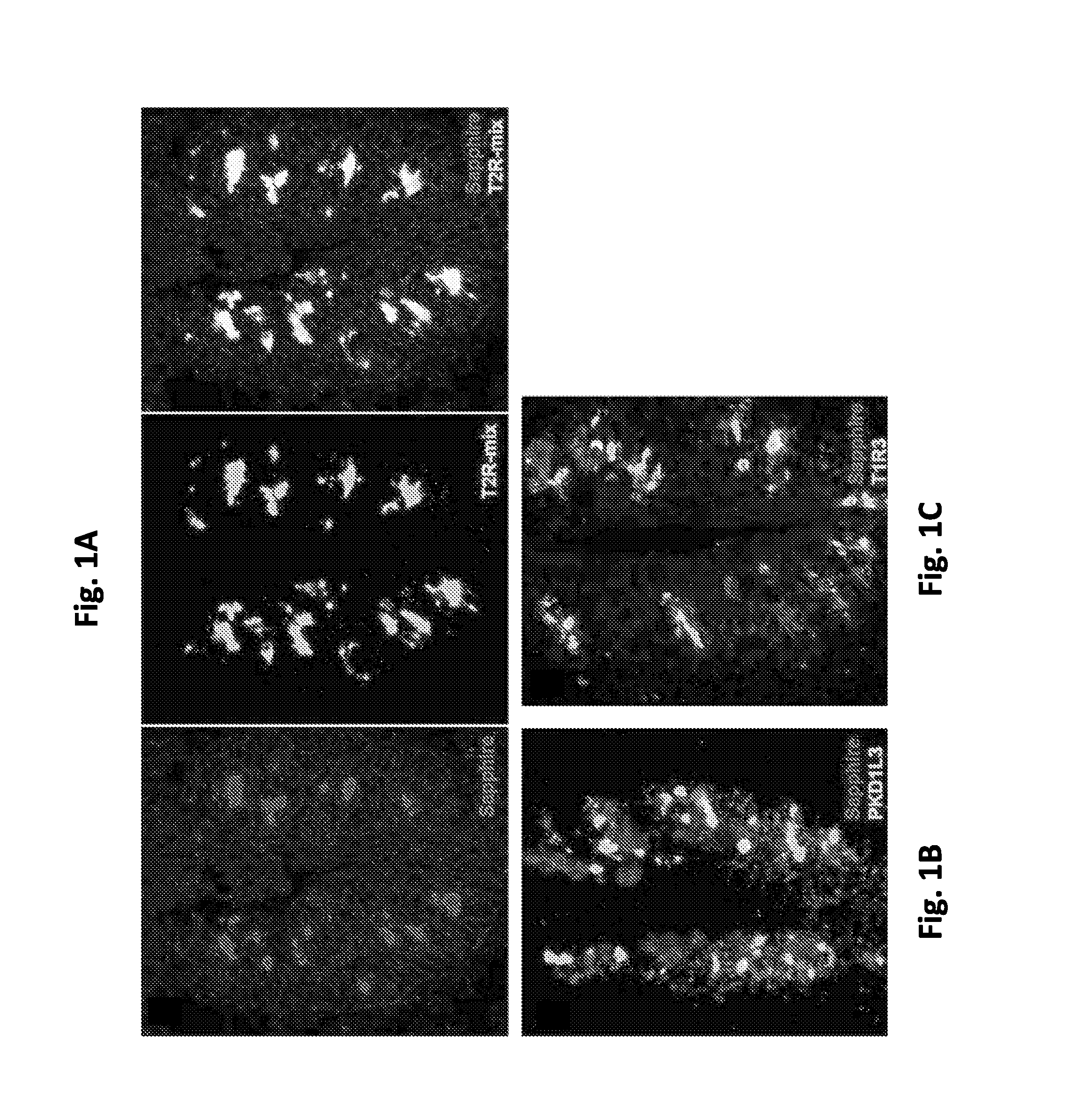 Modulation of salty taste perception by altering the function of bitter- or pkd2l1-expressing taste receptor cells