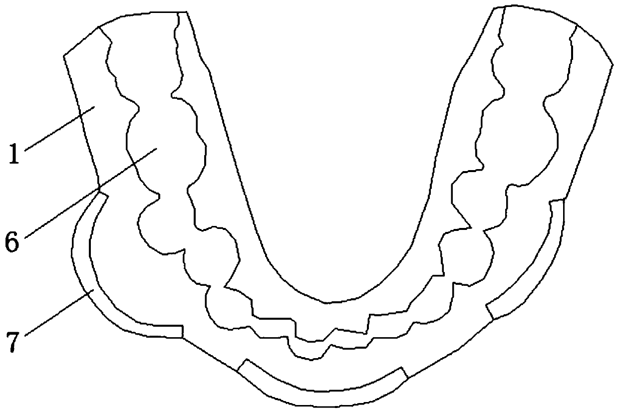 Individual lower jawbone navigation registration guide plate and registration method thereof