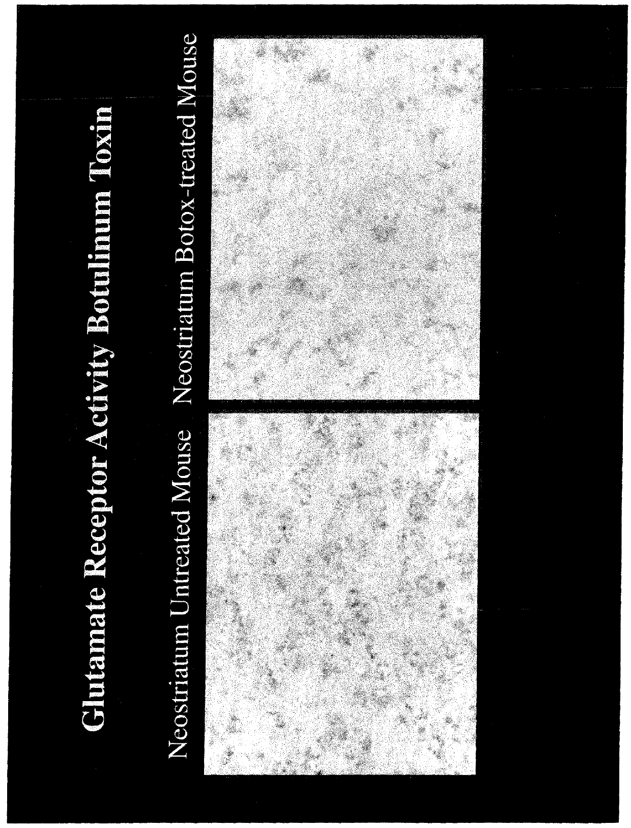 Botulinum Toxin and the Treatment of Primary Disorders of Mood and Affect