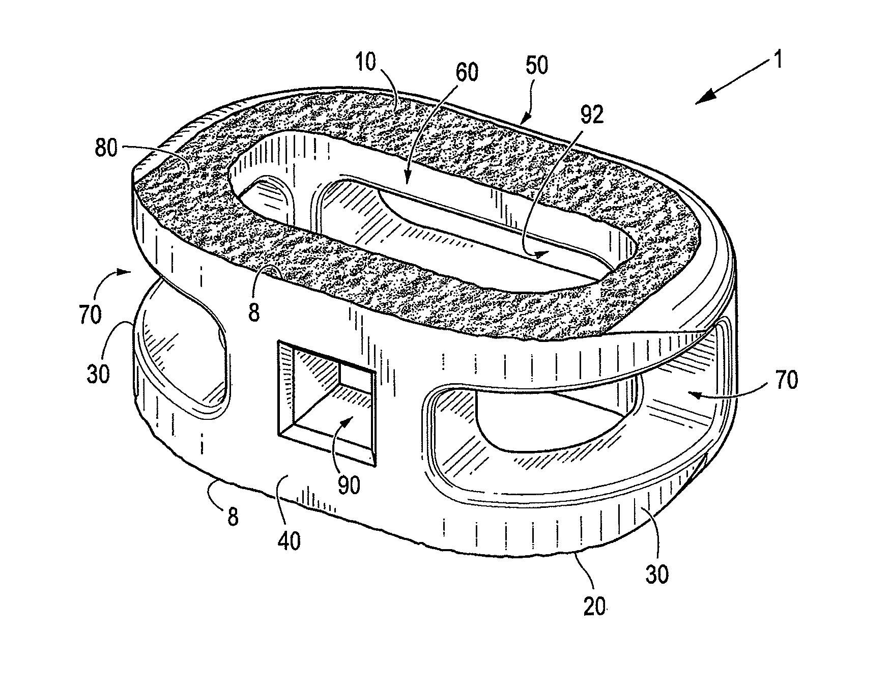 Method of using instruments and interbody spinal implants to enhance distraction