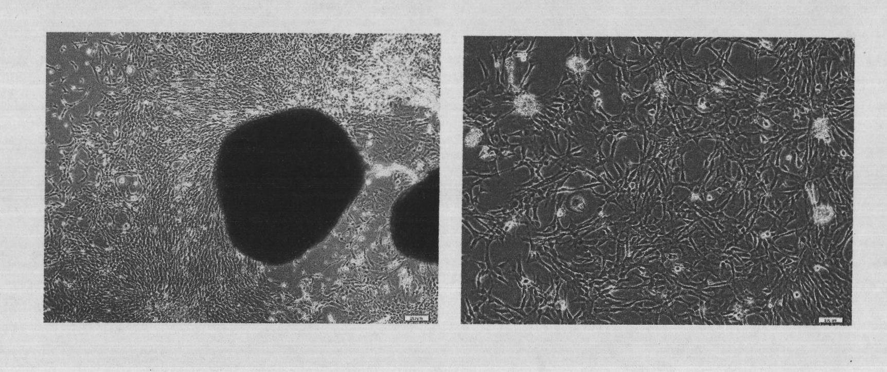 Large-scale preparation method of placenta mesenchymal stem cells