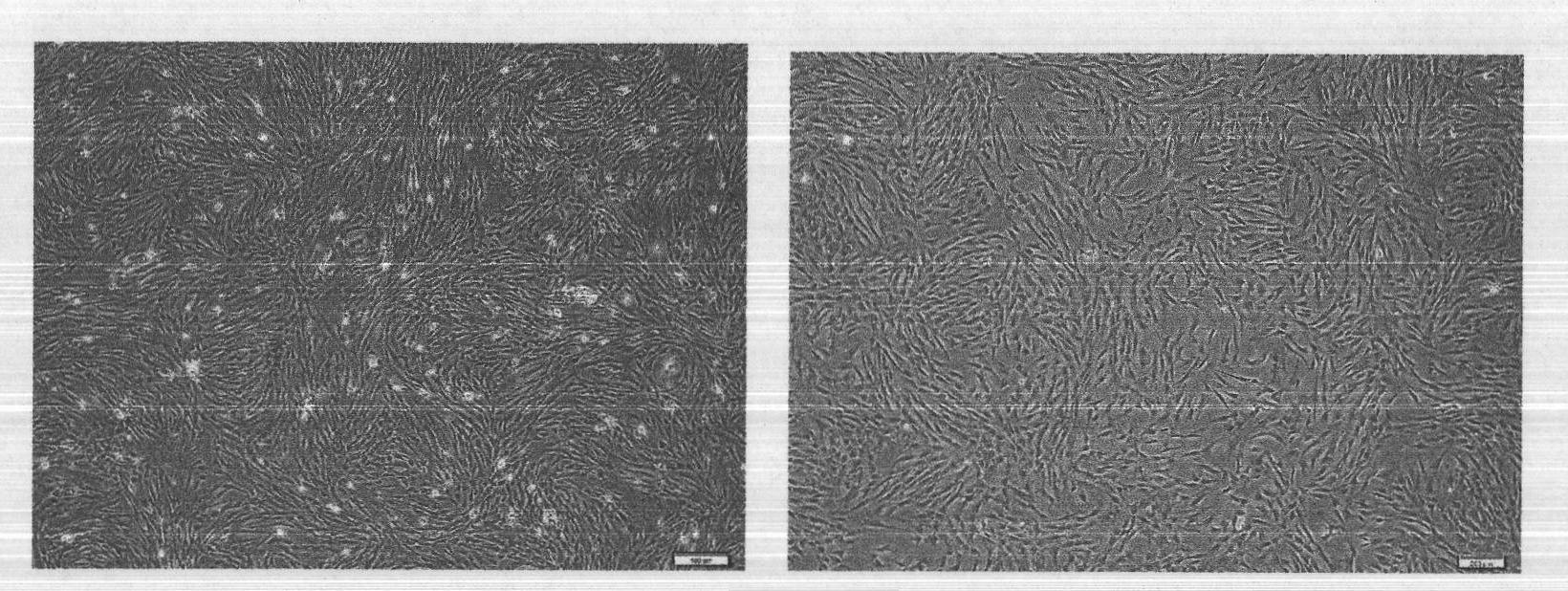 Large-scale preparation method of placenta mesenchymal stem cells