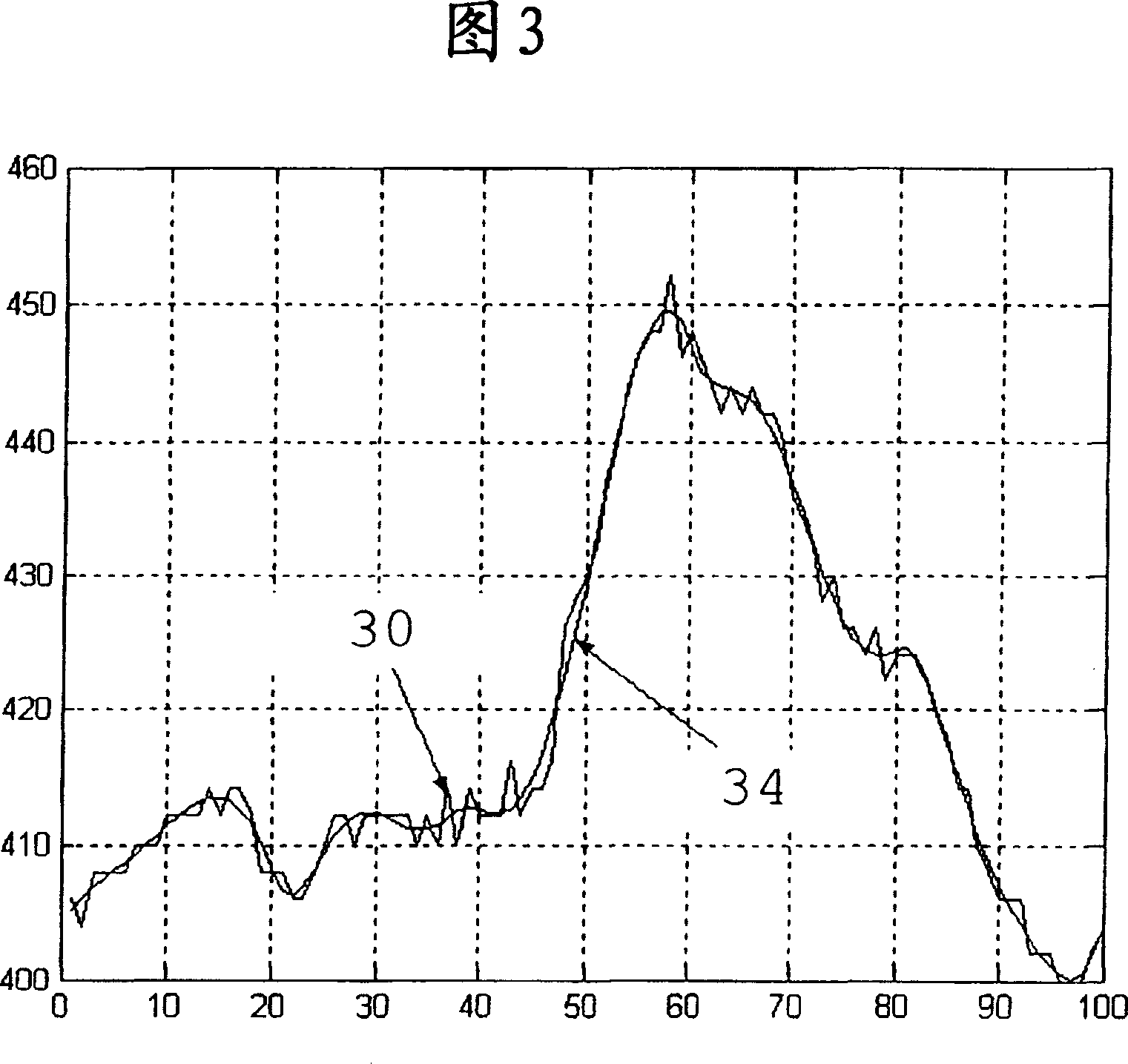 Assessment of fetal reactivity by fetal heart rate analysis