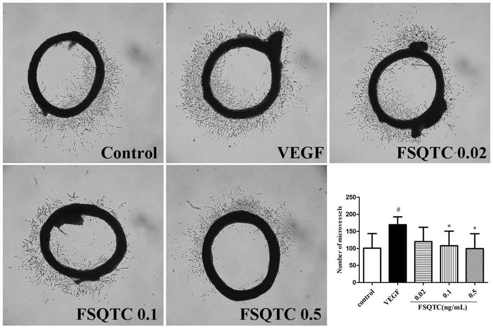 Use of rheumatic dampness dispelling pain traditional Chinese medicine composition in preparation of anti-angiogenesis drug