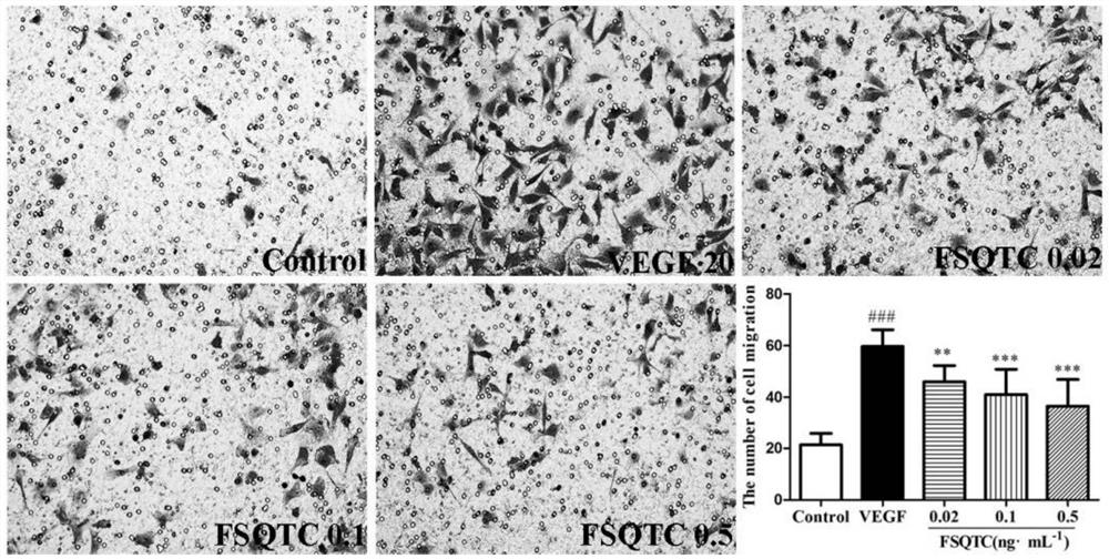 Use of rheumatic dampness dispelling pain traditional Chinese medicine composition in preparation of anti-angiogenesis drug