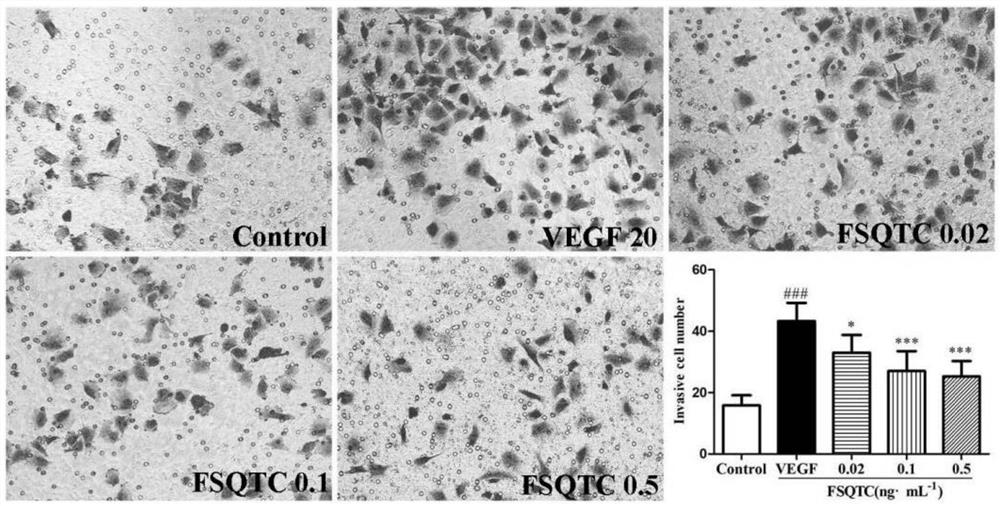 Use of rheumatic dampness dispelling pain traditional Chinese medicine composition in preparation of anti-angiogenesis drug