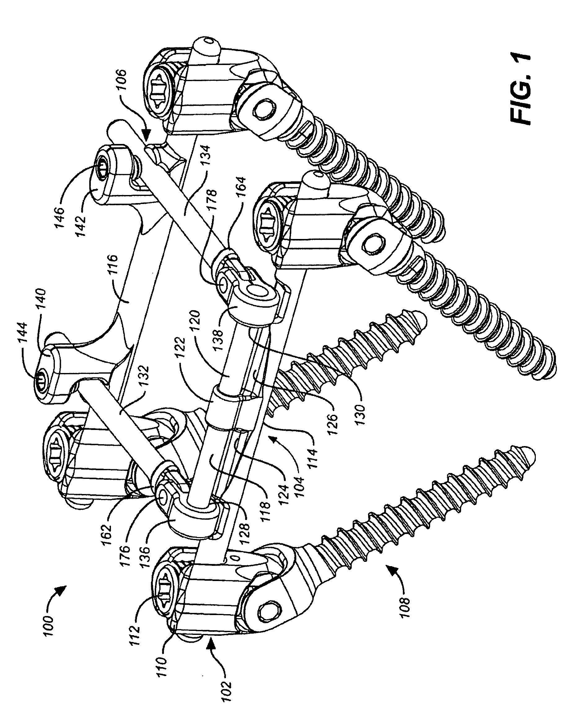 Deflection rod system dimensioned for deflection to a load characteristic for dynamic stabilization and motion preservation spinal implantation system and method