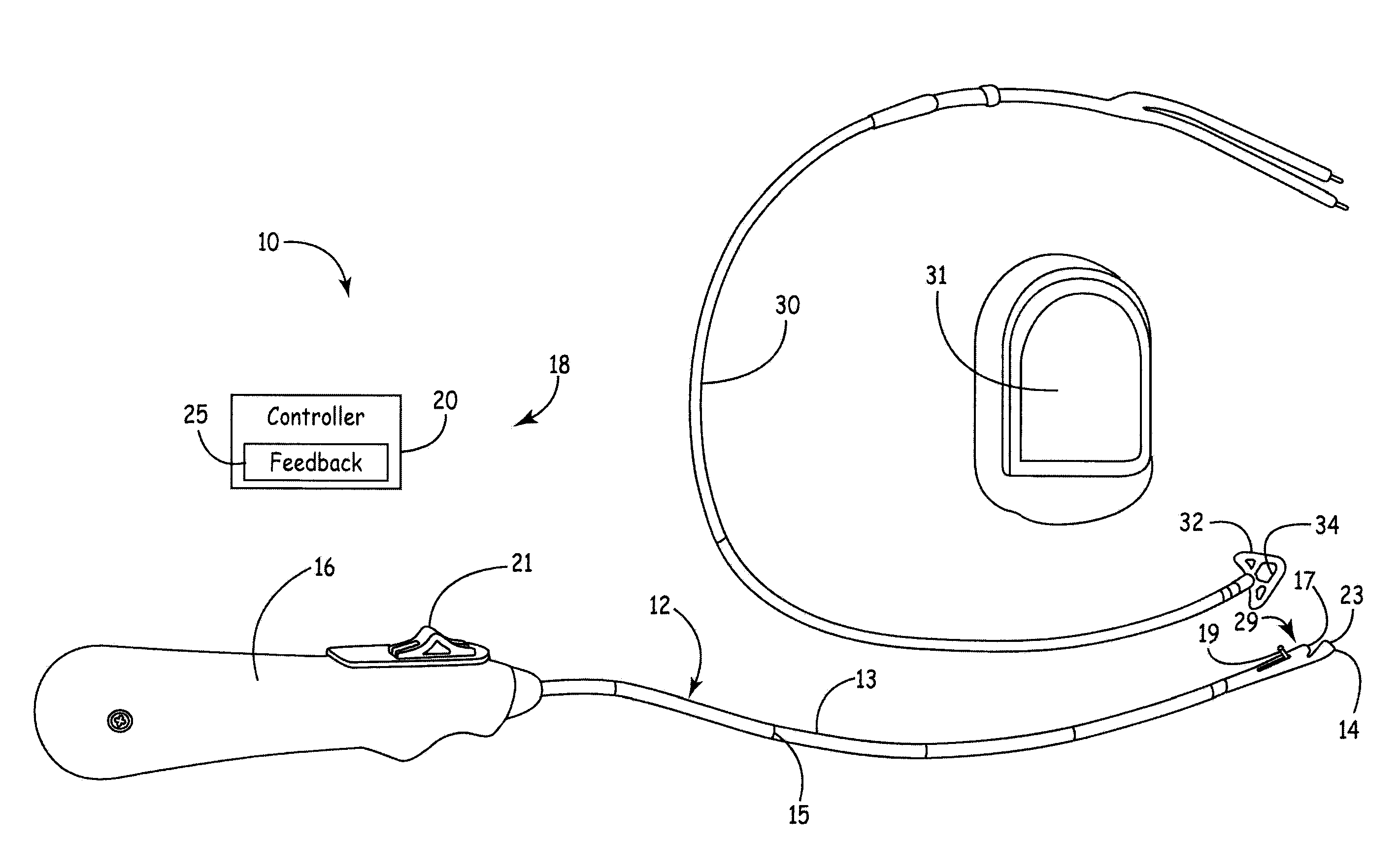 Ultrasonic guidance of subcutaneous tunneling