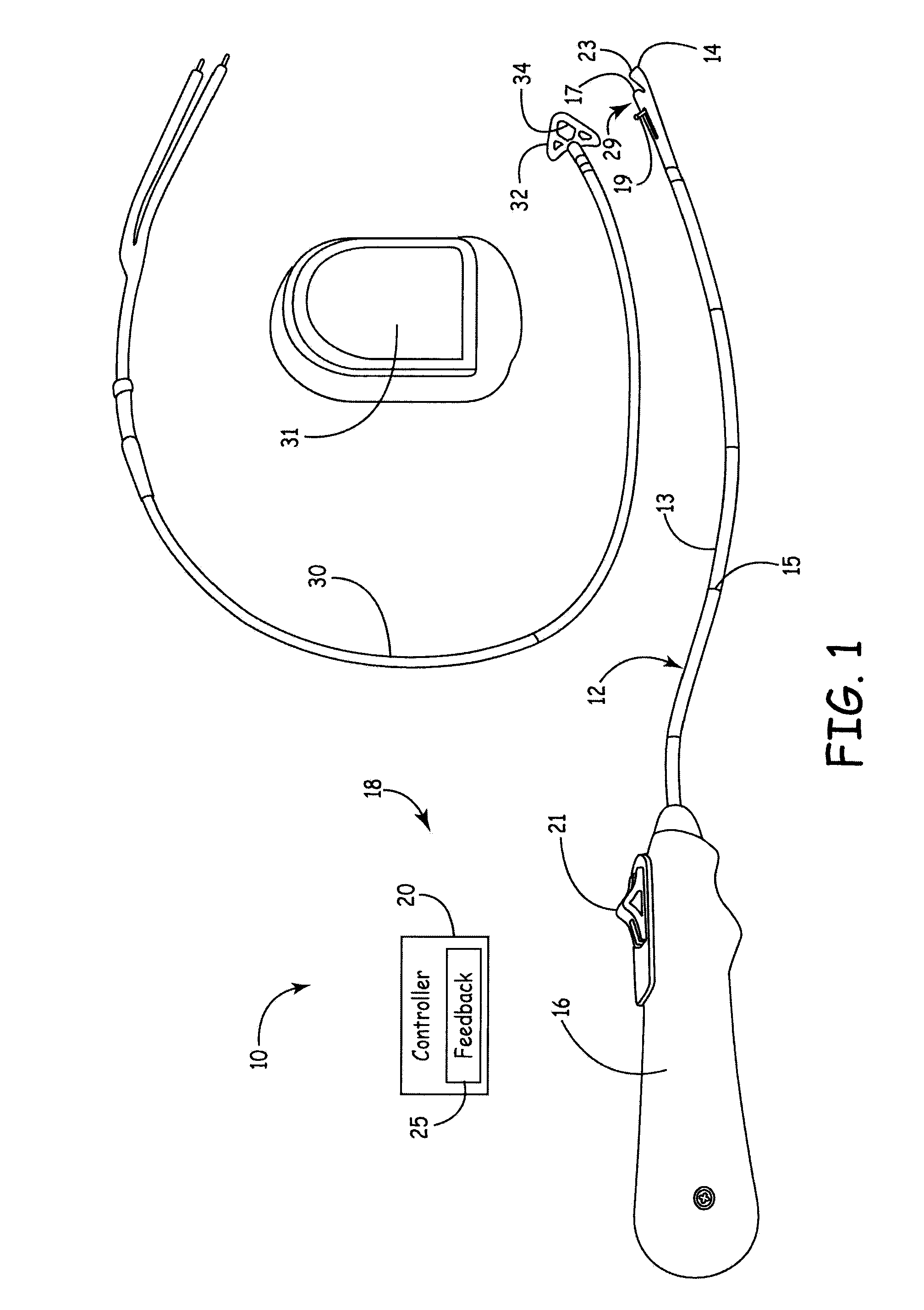 Ultrasonic guidance of subcutaneous tunneling