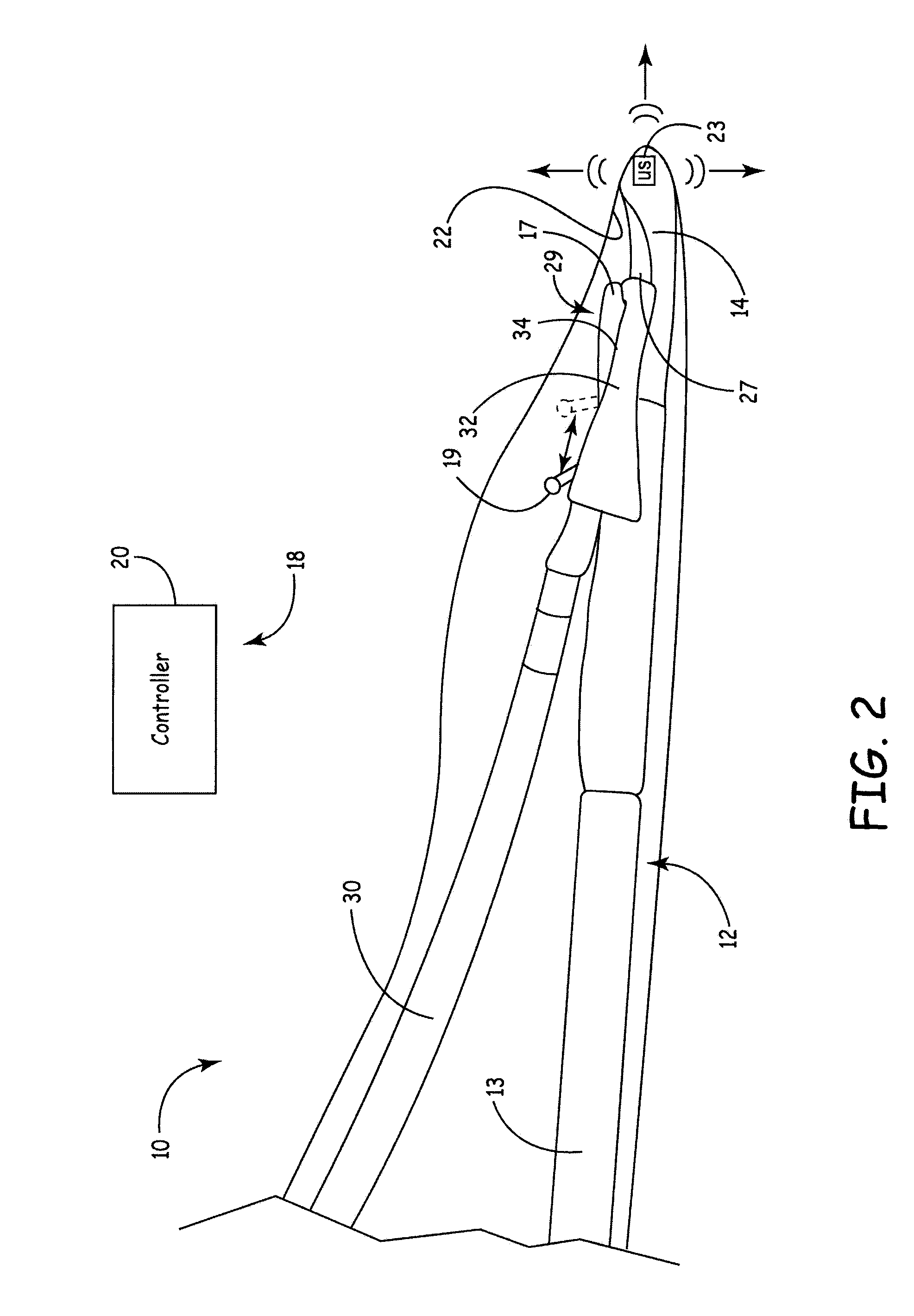 Ultrasonic guidance of subcutaneous tunneling