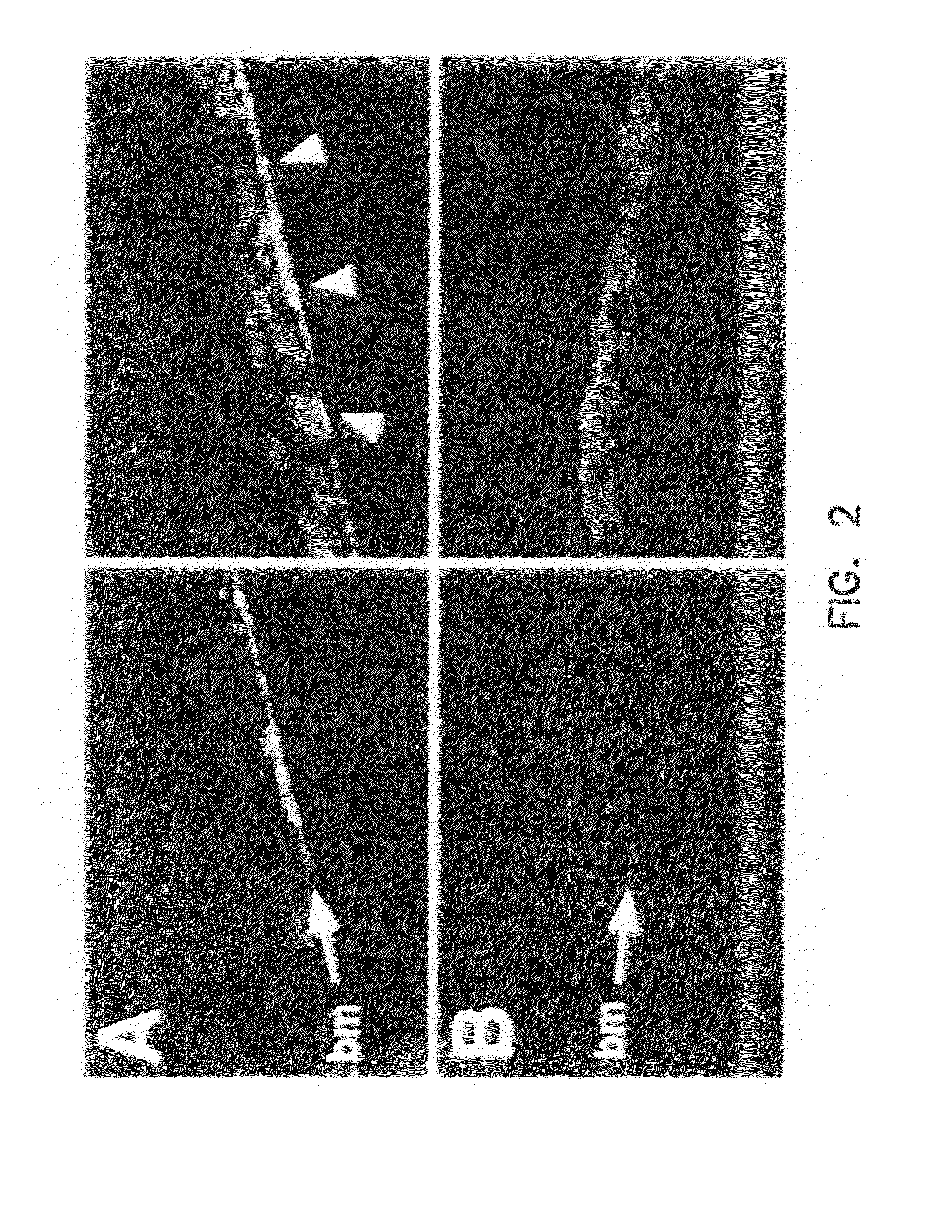 Compounds and methods to enhance rAAV transduction