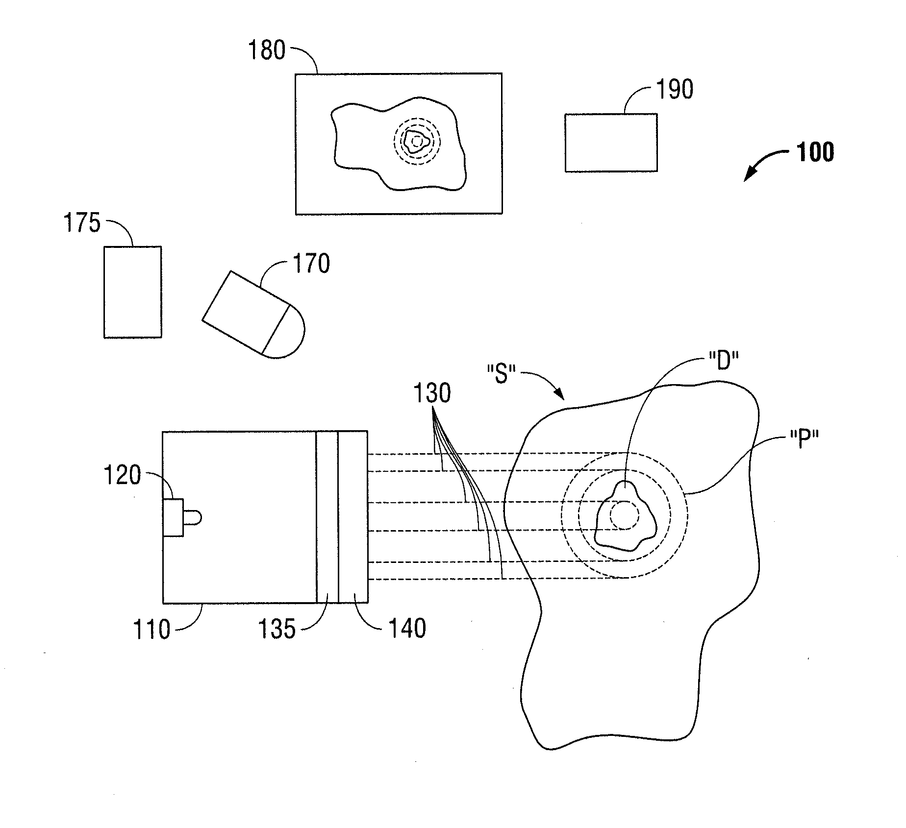 Telecentric Scale Projection System for Real-Time In-Situ Surgical Metrology