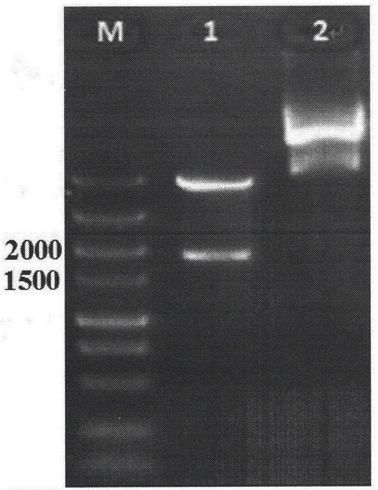 Helicobacter pylori tetravalent adhesion multi-epitope vaccine and preparation method thereof