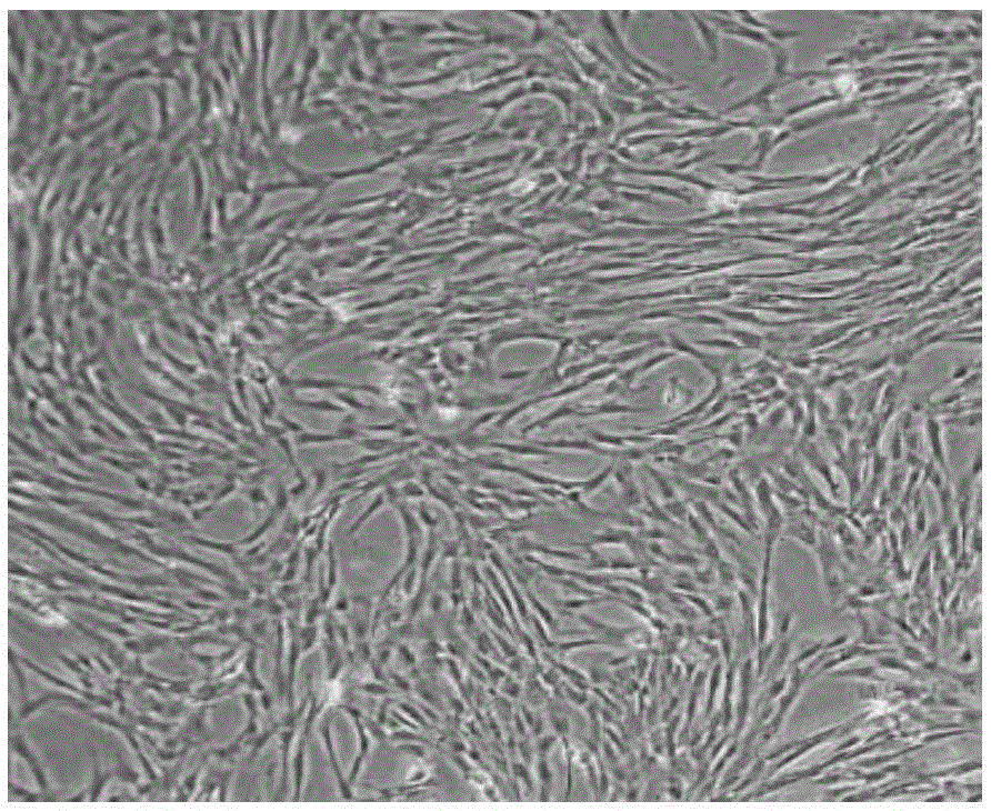 Umbilical cord tissue block cryopreservation method