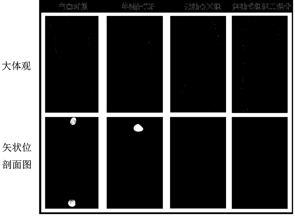 Construction and application of a coaxial vascularized tissue engineered bone