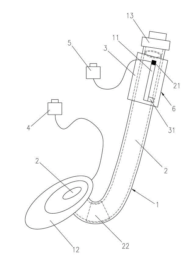 Combined air breather both of built-inBuilt-in tracheal catheter and laryngeal mask combined air breather for general anesthesia