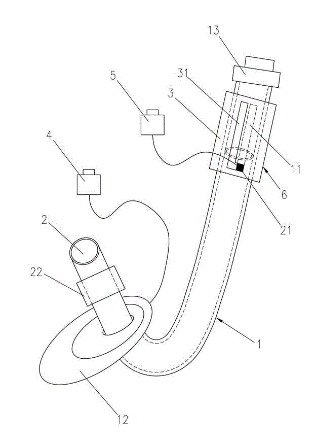 Combined air breather both of built-inBuilt-in tracheal catheter and laryngeal mask combined air breather for general anesthesia