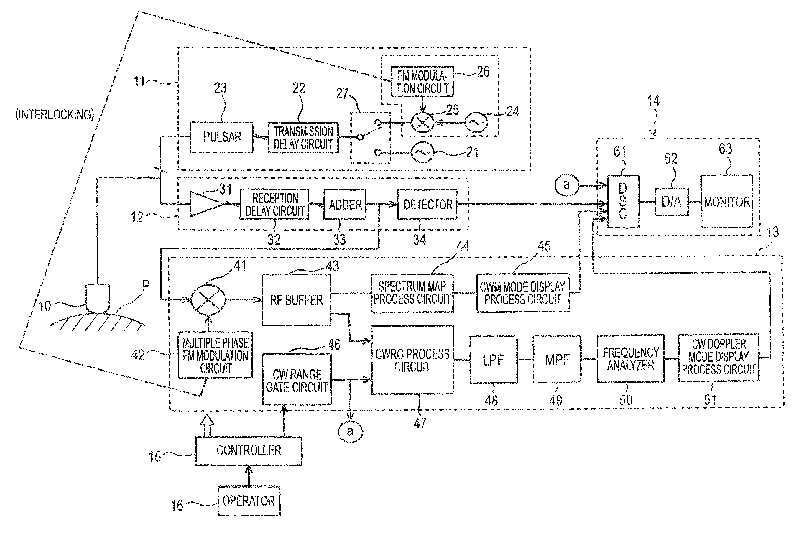 Ultrasonic Doppler Diagnosis Device