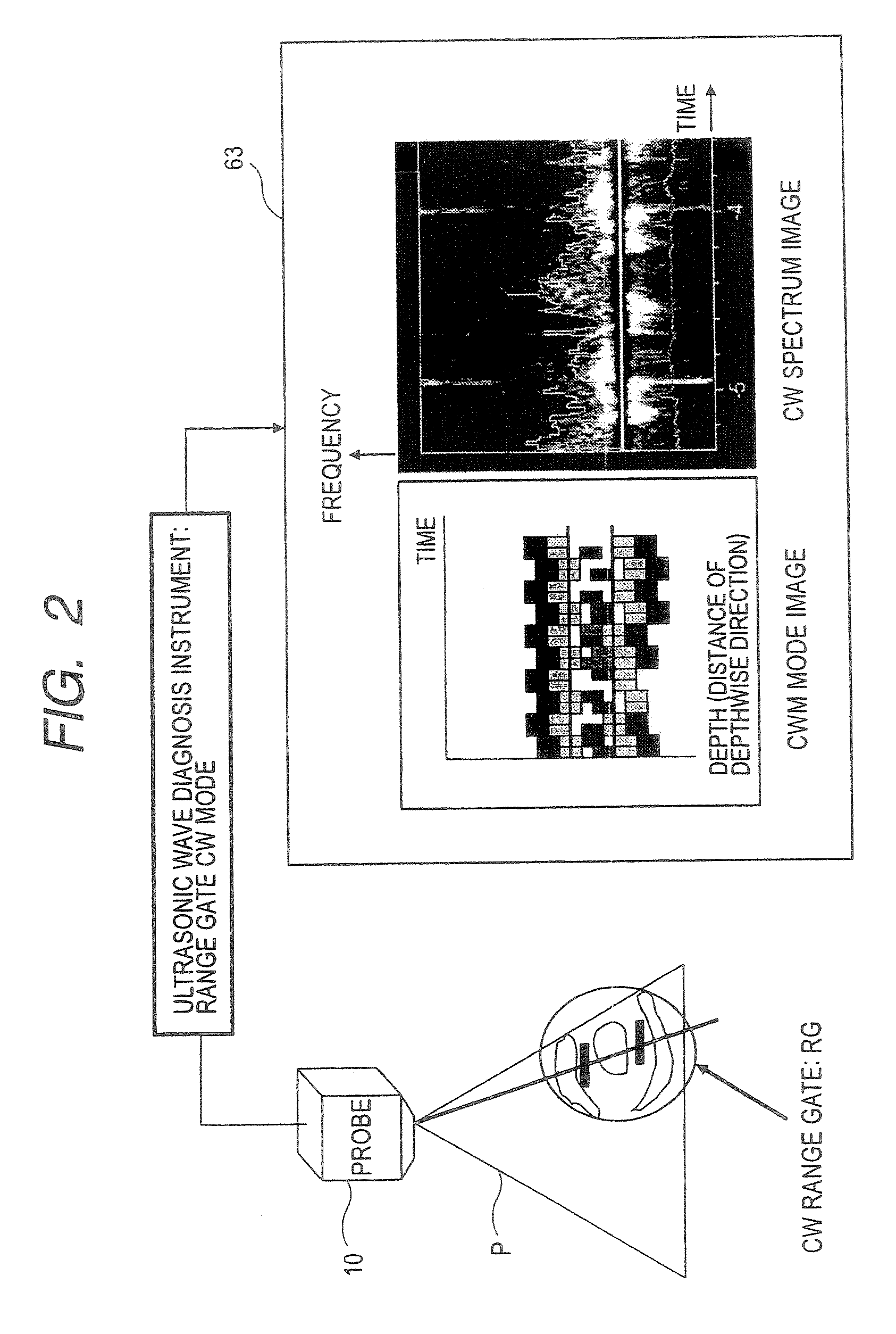 Ultrasonic Doppler Diagnosis Device