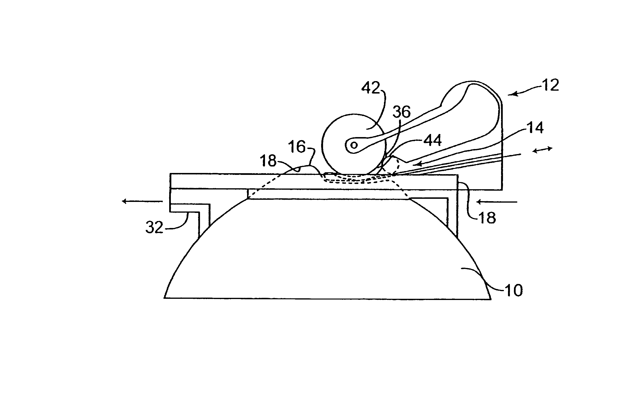 Device for separating the epithelium layer from the surface of the cornea of an eye