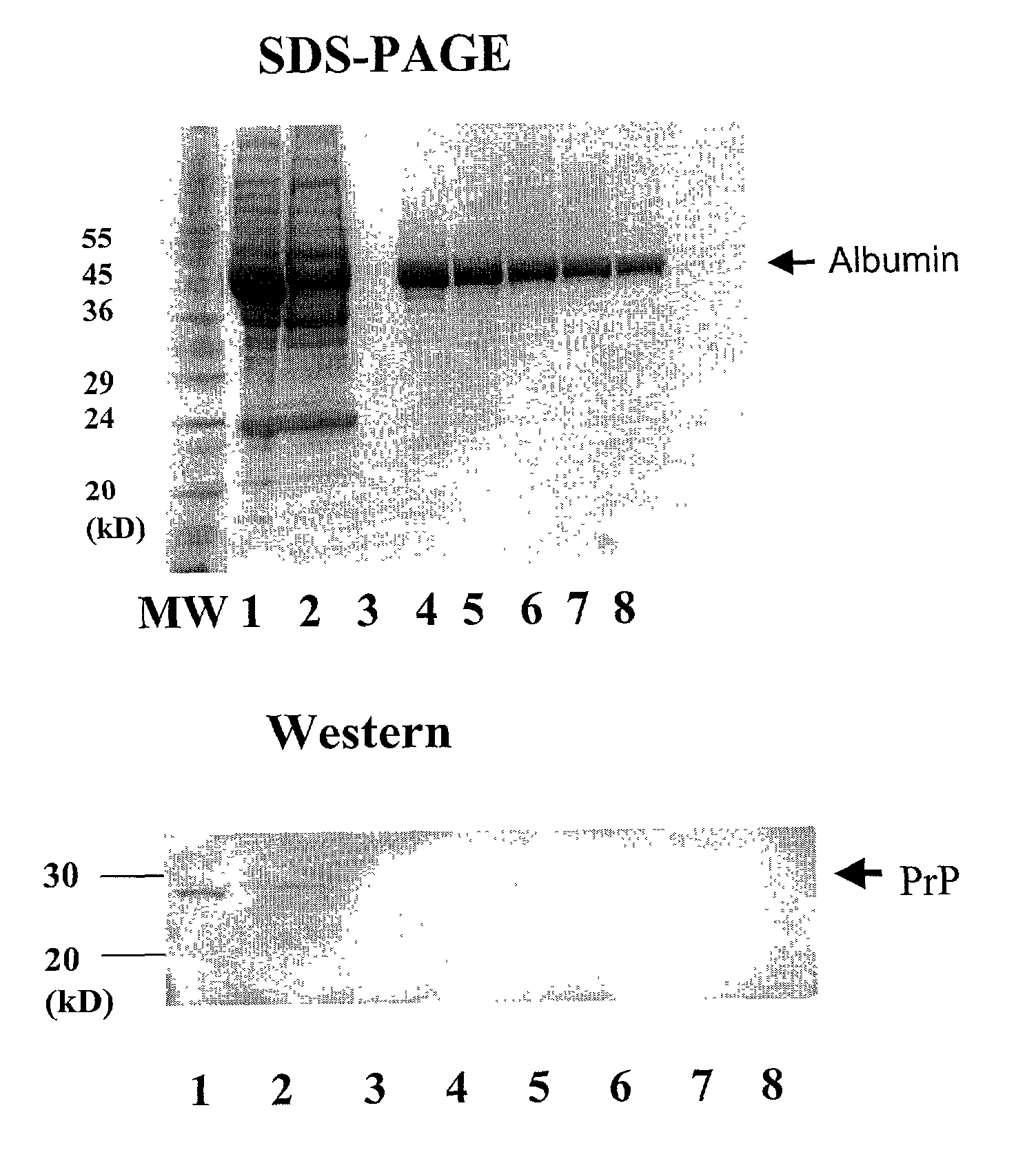 Apparatus and method for separation of biological contaminants