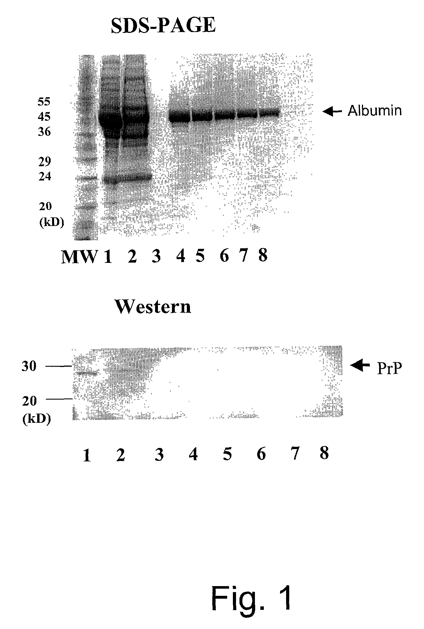 Apparatus and method for separation of biological contaminants