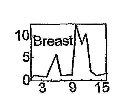 System And Method For Classifying A Body Tissue Sample