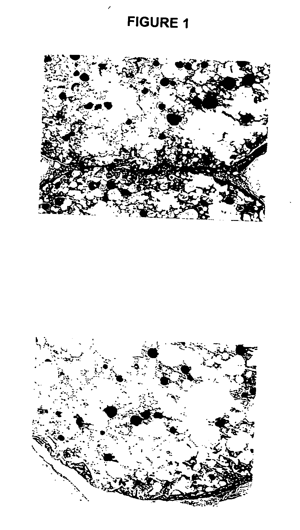 Biocompatible polymer compositions for dual or multi staged curing