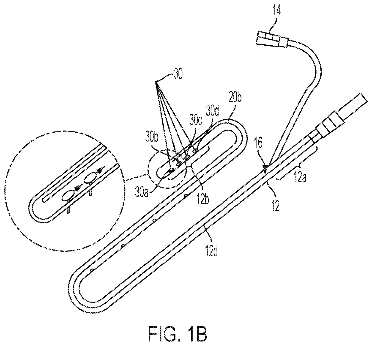 Positioning a tube in a lumen via transillumination