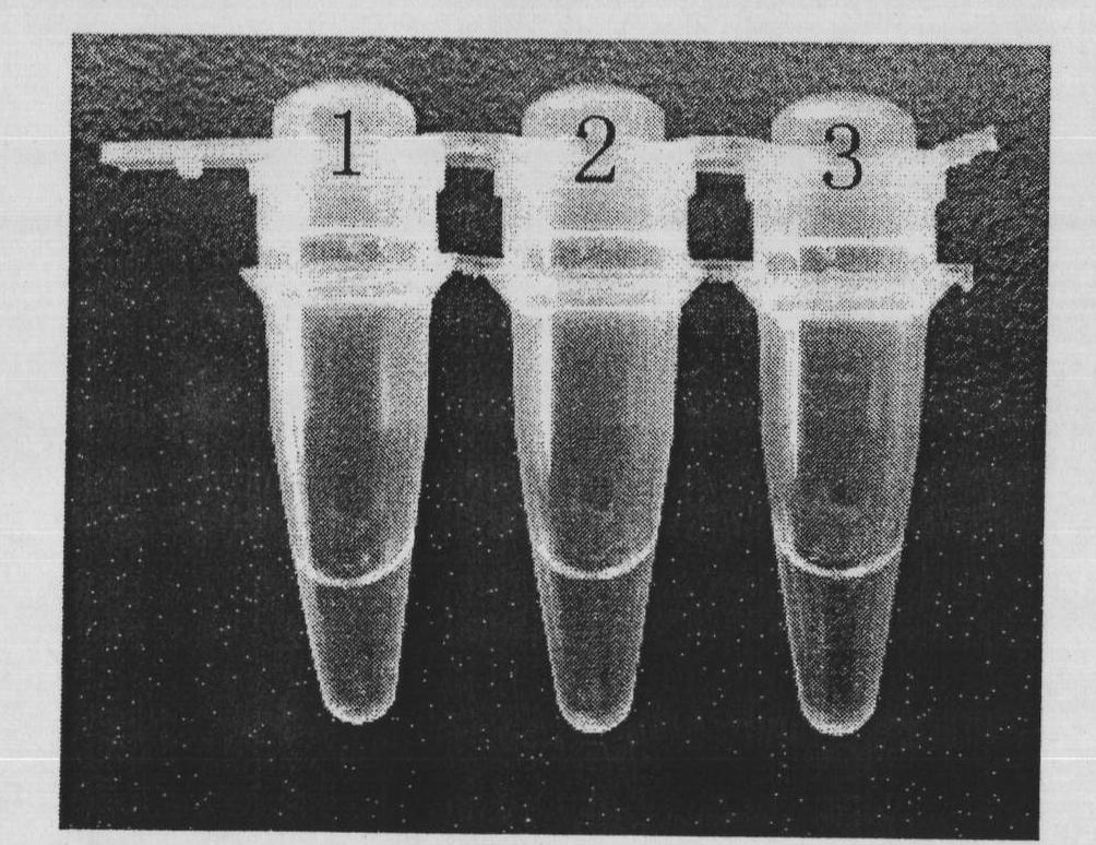 Nucleic acid screening method of staphylococcus aureus, salmonella, shigella and listeria monocytogenes