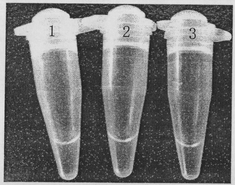 Nucleic acid screening method of staphylococcus aureus, salmonella, shigella and listeria monocytogenes