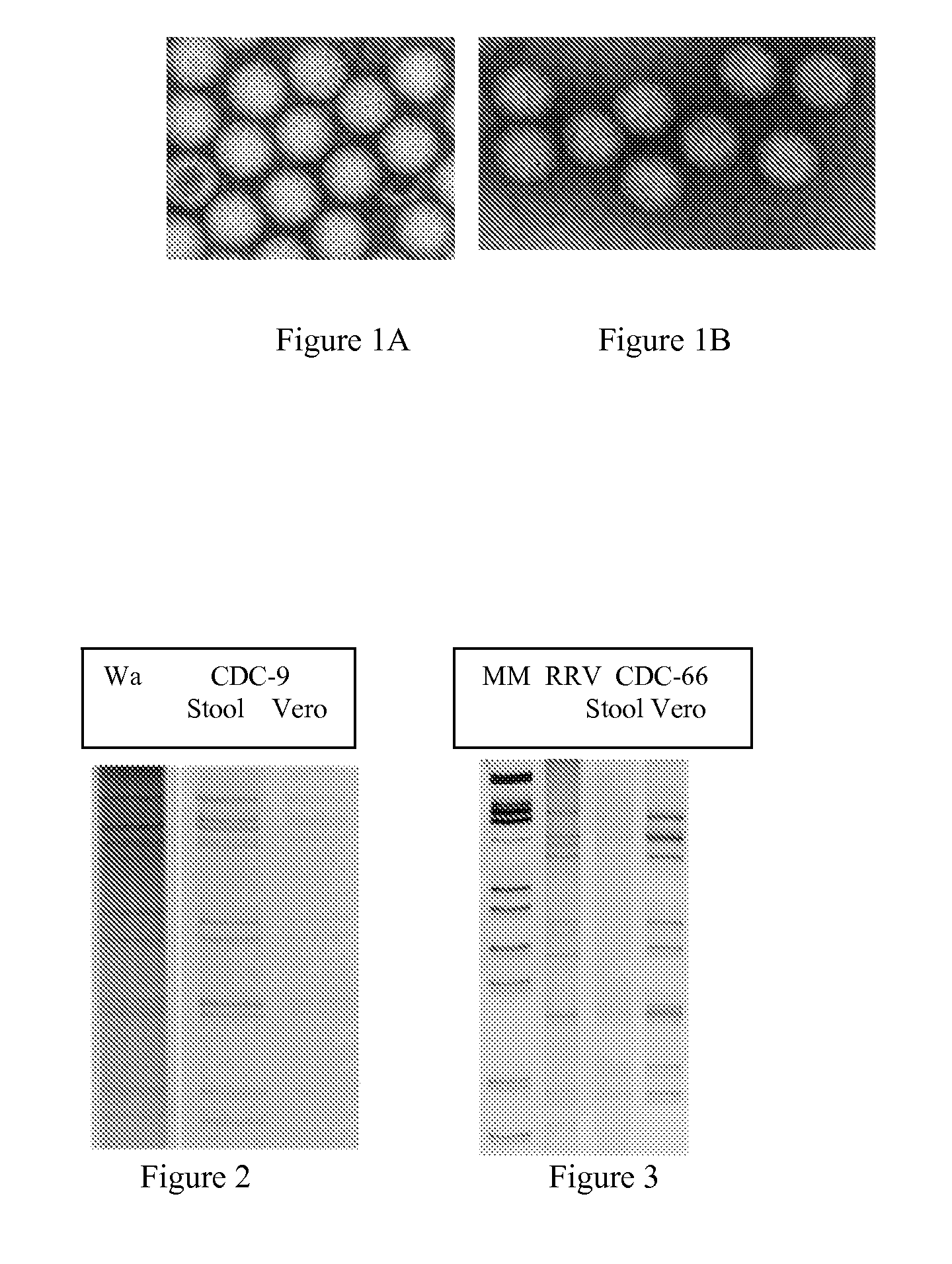 Human rotavirus vaccine strains and diagnostics