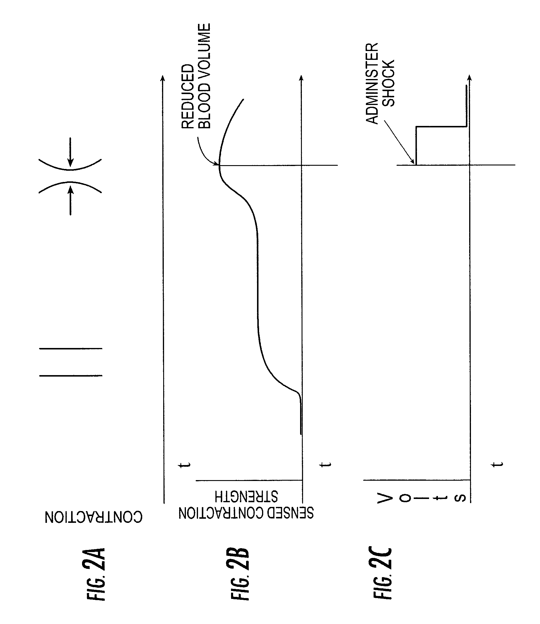 Methods and systems for reducing discomfort from cardiac defibrillation shocks